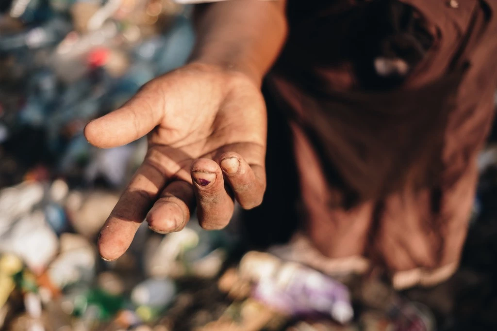 Miriam Nyambura shows the cuts on her fingers from sifting through broken glass at the Dandora dump. 