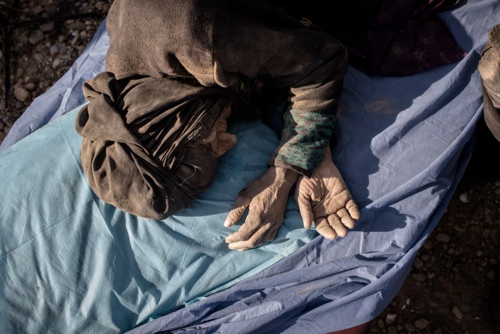 An injured civilian lies on a stretcher at a clinic south of Mosul, Iraq on Feb. 23, 2017.