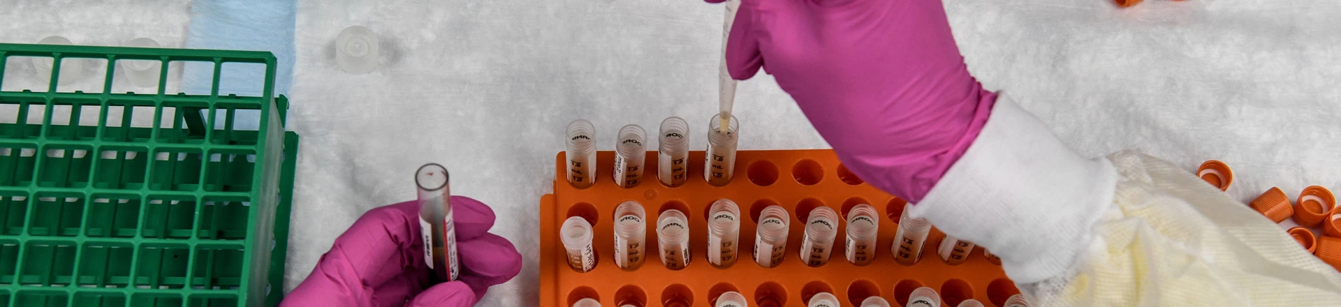 Um técnico de laboratório classifica amostras de sangue para estudos de vacinação contra covid-19 nos Research Centers of America em Hollywood, na Flórida, em 13 de agosto de 2020. Foto: Chandan Khanna/AFP via Getty Images Um técnico de laboratório classifica amostras de sangue para estudos de vacinação contra covid-19 nos Research Centers of America em Hollywood, na Flórida, em 13 de agosto de 2020. Foto: Chandan Khanna/AFP via Getty Images
