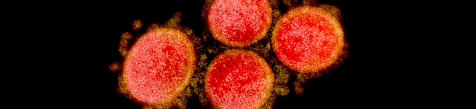 Micrografia eletrônica de transmissão de partículas do vírus SARS-CoV-2. Micrografia eletrônica de transmissão de partículas do vírus SARS-CoV-2.