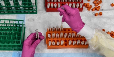 Um técnico de laboratório classifica amostras de sangue para estudos de vacinação contra covid-19 nos Research Centers of America em Hollywood, na Flórida, em 13 de agosto de 2020. Foto: Chandan Khanna/AFP via Getty Images