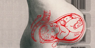 Casais de mulheres não conseguem registrar bebês fruto de inseminação caseira – mas casais hétero, sim Casais de mulheres não conseguem registrar bebês fruto de inseminação caseira – mas casais hétero, sim