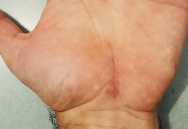 ‘Quando alguém me diz que agrotóxicos não fazem mal, eu mostro minhas mãos’ ‘Quando alguém me diz que agrotóxicos não fazem mal, eu mostro minhas mãos’