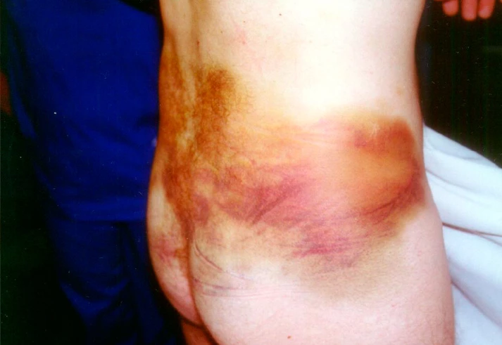 Os detalhes do processo contra ativistas paraguaios que Bolsonaro e Moro querem expulsar do Brasil