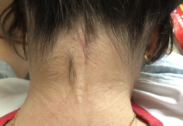 ‘Tenho uma doença rara incompreendida pelos médicos’: como é conviver diariamente com a dor ‘Tenho uma doença rara incompreendida pelos médicos’: como é conviver diariamente com a dor