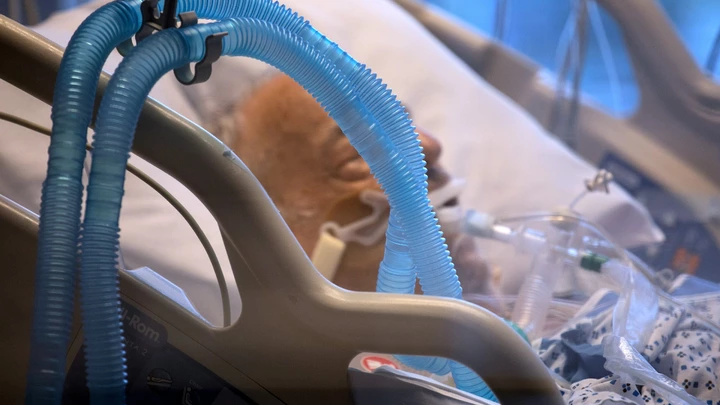 Paciente da covid-19 mantido na UTI com uso do respirador. Paciente da covid-19 mantido na UTI com uso do respirador.